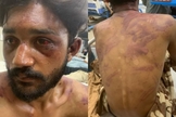 Ikhlaq Masih no hospital. (Foto: International Christian Concern).