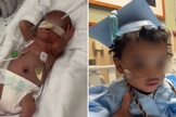 Após 11 meses na UTIN, Adonis recebeu alta. (Foto: Reprodução/CBS News)
