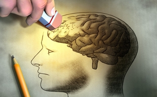 alzheimer