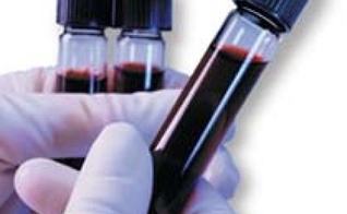 pesquisa no sangue