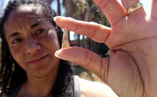 Mãe mostra dente que a filha perdeu após apanhar na escola em Sorocaba