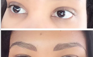 Prótese de sobrancelha é destaque em tratamento de beleza