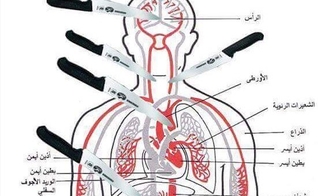 Imagem mostra os pontos principais do corpo a serem atingidos por uma faca, causando rápida fatalidade. (Foto: Times of Israel)