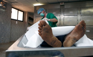 O procedimento não será capaz de dar vida nova às pessoas que faleceram, mas sim, às que vivem somente com o auxílio de aparelhos médicos. (Foto: Reprodução)