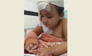 Sua mãe diz que pelo menos ele parou de chorar depois de cada cirurgia. (Foto: Reprodução).
