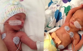 Nico e Camila nasceram na última semana e conheceram os braços de sua mãe. (Foto: Reprodução/ABC 7 News)