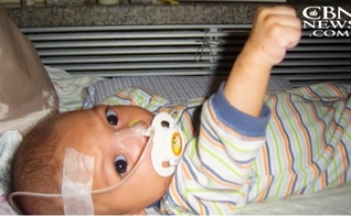 Um tumor na boca, impedia que o bebê se alimentasse normalmente. (Imagem: CBN News)
