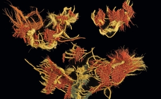 Vestígios dos tecidos do tempo do Rei Salomão. (Foto: Autoridade de Antiguidades de Israel)