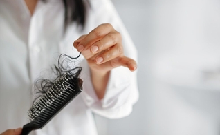 Em média, perdemos cerca de 80 fios de cabelo por dia. (Foto: iStock/Think Stock/Getty Images)
