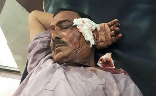 Além dos tijolos, mais de 15 muçulmanos usaram armas de fogo contra os fiéis. (Foto: Morning Star News).