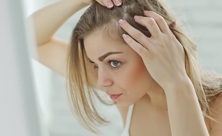 Mais de 50% das mulheres têm alguma queixa relacionada à queda de cabelos. (Foto: Shutterstock)