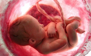 Abortos foram a maior causa de mortes no mundo, em 2018. (Imagem: Aleteia)
