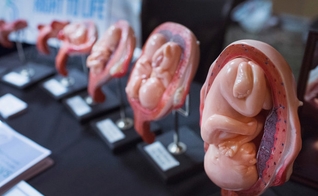 Peças em consultório mostram estágios de um bebê em gestação. (Foto: NY Post)