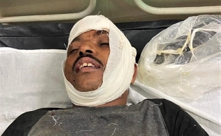 o pastor Isaac Paulose, 48 anos, foi espancado e atropelado cinco vezes por motos. (Foto: Morning Star News)