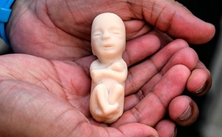 Militante pró-vida segura nas mães uma representação de bebê em idade gestacional. (Foto: AFP)