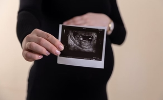 Sobe número de abortos na Escócia. (Foto representativa: Unsplash/Volodymyr Hryshchenko)