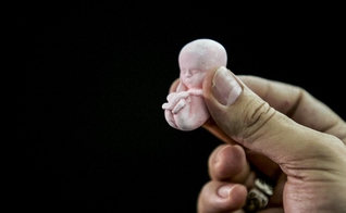 Maioria dos brasileiros são contra qualquer tipo de aborto e apoiam sua proibição. (Foto: Bruno Domingos/Reuters)
