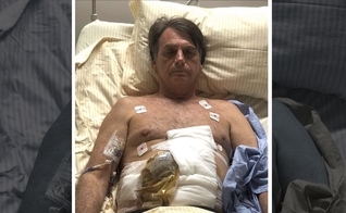 O candidato Jair Bolsonaro foi submetido a uma cirurgia de emergência no intestino. (Foto: Reprodução)