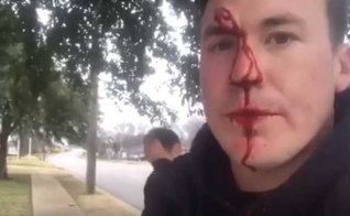 Ryan Roberts ensanguentado após sofrer agressões por causa de seu ativismo pró-vida. (Foto: Reprodução/YouTube).
