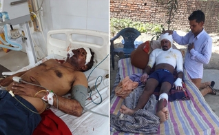 Cristãos espancado e pastor que teve o corpo incendiado recebe oração de um cristão, irmão do pastor Rashphal. (Foto: Divulgação/Rashphal.)