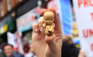 Manifestante segura modelo de um embrião de 12 semanas em uma manifestação contra o aborto em Belfast. (Foto: Reprodução/Reuters)