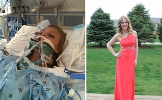 Taylor Hale internada na UTI e hoje, com 17 anos, antes de seu baile de formatura. (Foto: Reprodução/Stacy Henningsen).
