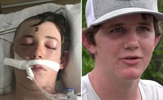 : Caleb quando estava em como e hoje, recuperado. (Foto: Reprodução/WTSP)