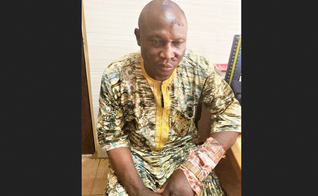 Pastores muçulmanos Fulani feriram o pastor batista Elisha Noma enquanto o mantinham em cativeiro. (Foto: Reprodução/Morning Star News)