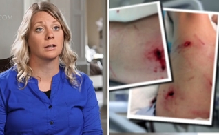 Casadi Schroeder foi atacada por um urso durante um acampamento bíblico no Canadá. (Foto: CBN News)