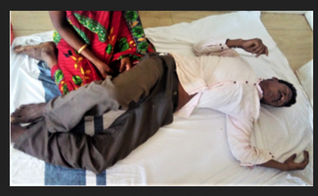 Kama Sodi diante de sua esposa, depois de aldeões animistas o espancarem no estado de Odisha, na Índia. (Foto: Reprodução / Morning Star News)