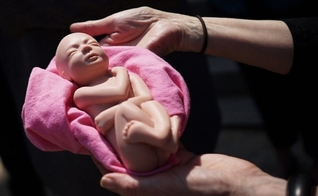 A França realiza cerca de 220.000 abortos legais todos os anos. (Foto: Mandel Ngan / AFP / Getty)