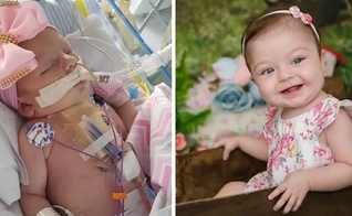 Ayla durante internação, e hoje, com 1 aninho. (Foto: Reprodução / Arquivo pessoal)