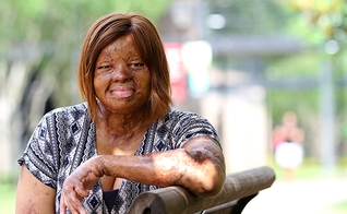 Kechi Okwuchi sobreviveu a uma queda de avião em 2005 na Nigéria. (Foto: Daily Word)