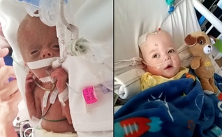 Kingston Lane passou os primeiros 10 meses de vida em uma batalha. (Foto: Brittany Lane/Facebook|WFIE)