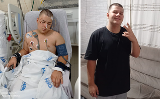 Nathan, de 16 anos, sofreu um grave acidente ao cair de uma bicicleta. (Foto: Reprodução / Lance Notícias)