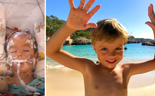 Blake após cirurgia, e hoje completamente restaurado. (Foto: Reprodução / Facebook)