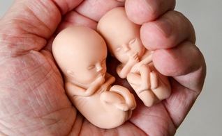 Aumento se deu em função da liberação dos procedimentos em casa em meio à pandemia. (Foto: Reprodução / Right To Life)