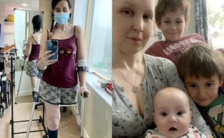 Kathleen Osborne, de 28 anos, precisou escolher entre abortar sua filha para fazer quimioterapia ou amputar sua perna. (Foto: Kathleen Osborne).