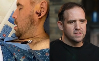  Joshua Rowe foi livrado da morte em assalto durante uma corrida. (Foto: Reprodução/CBN News).