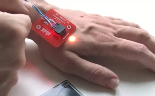 Um raio-x mostra um implante Walletmor, que é injetado na mão de uma pessoa após um anestésico local. (Foto: Reprodução / BBC)