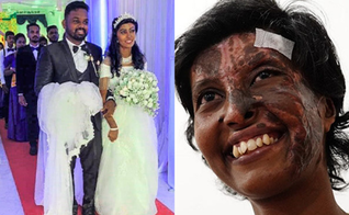 Rebekah em seu casamento com Kaushik; ao lado, após sofrer queimaduras durante ataque em 2019. (Foto: Reprodução / Open Doors)