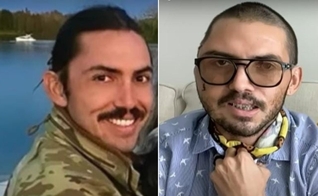Juan Carlos La Verde, antes e depois do acidente. (Foto: Captura de tela/YouTube Inside Edition/Montagem)