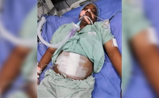 Sukhdev Mark, de 47 anos, foi atacado por três homens. (Foto: Morning Star News).