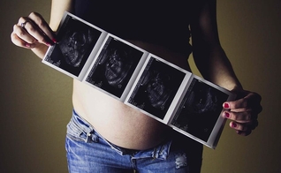 As pesquisas dizem que a maioria da população apoia o direito ao aborto na Espanha. (Foto ilustrativa: Piqsels)