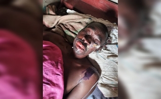 Frank Mutabaazi sofreu uma emboscada de um extremista, em Kampala. (Foto: Morning Star News).