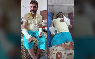 Missionário com os braços quebrados no Paquistão. (Foto: Mission Cry/Montagem)