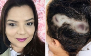 Fernanda Marcelino sobreviveu por um milagre. (Foto: Arquivo pessoal/G1)