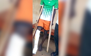 Musa Kirongosa após a agressão. (Foto: Reprodução/Morning Star News)