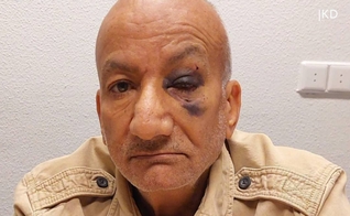 Idoso foi agredido por socos no rosto. (Captura de tela/Omroep West)