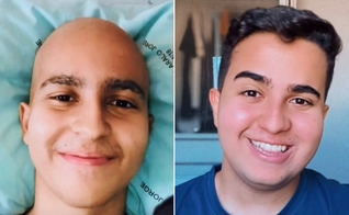 Lucas Teodoro antes e depois do câncer. (Foto: Reprodução/Instagram/Lucas Teodoro)